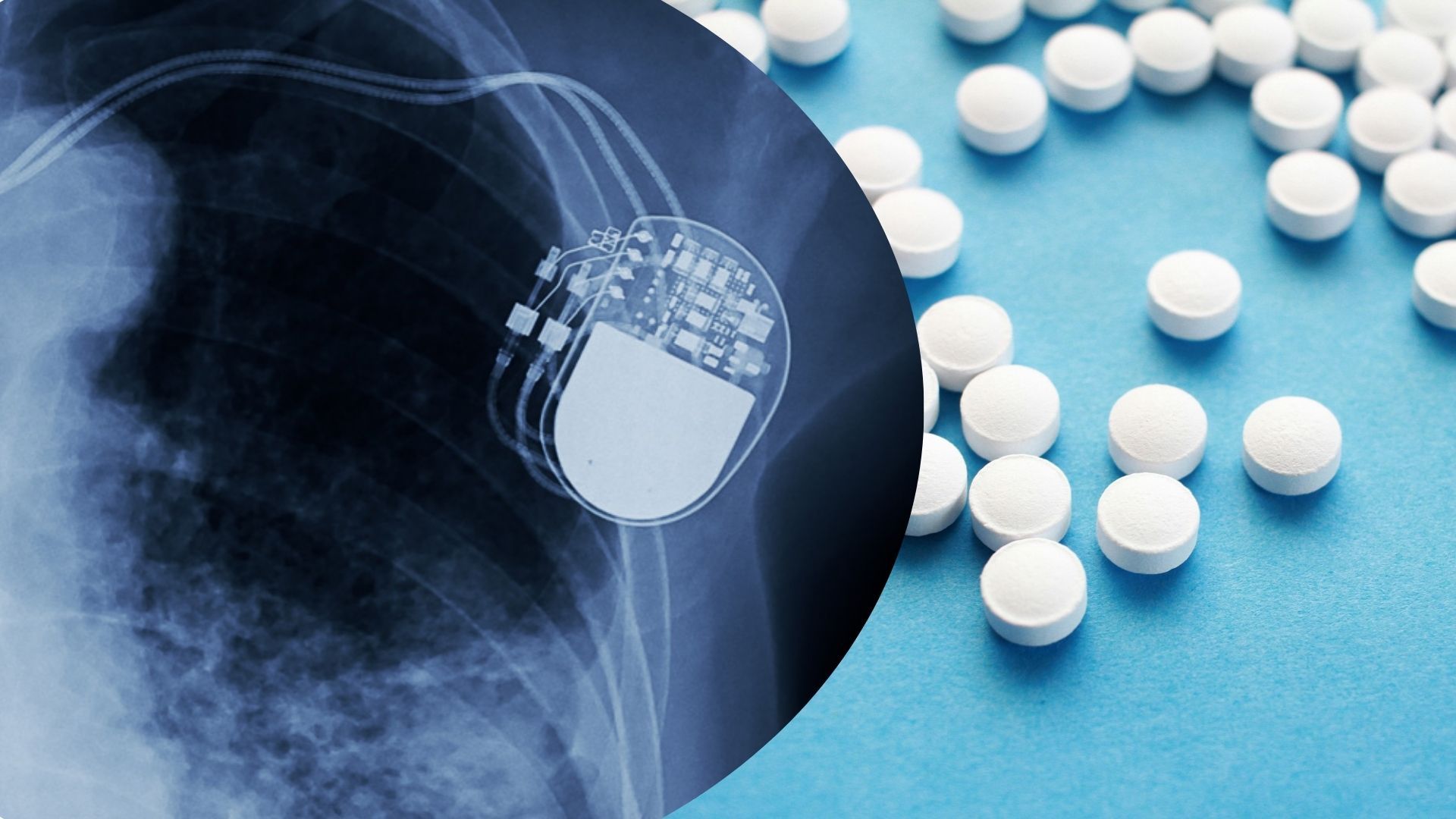 Винаходи, які створили випадково - Цікаве 24 Винаходи, які створили випадково - Цікаве 24